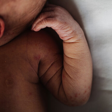 Συγγενείς-Παραμορφώσεις