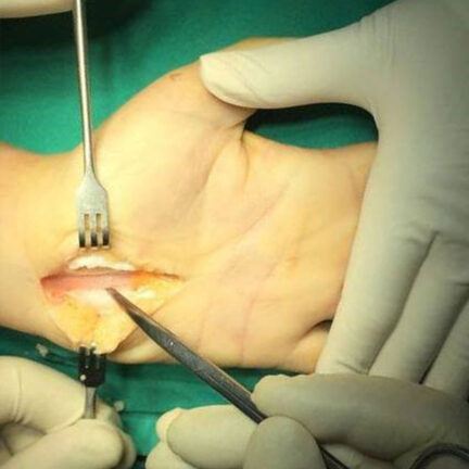 Χειρουργική-Χεριού